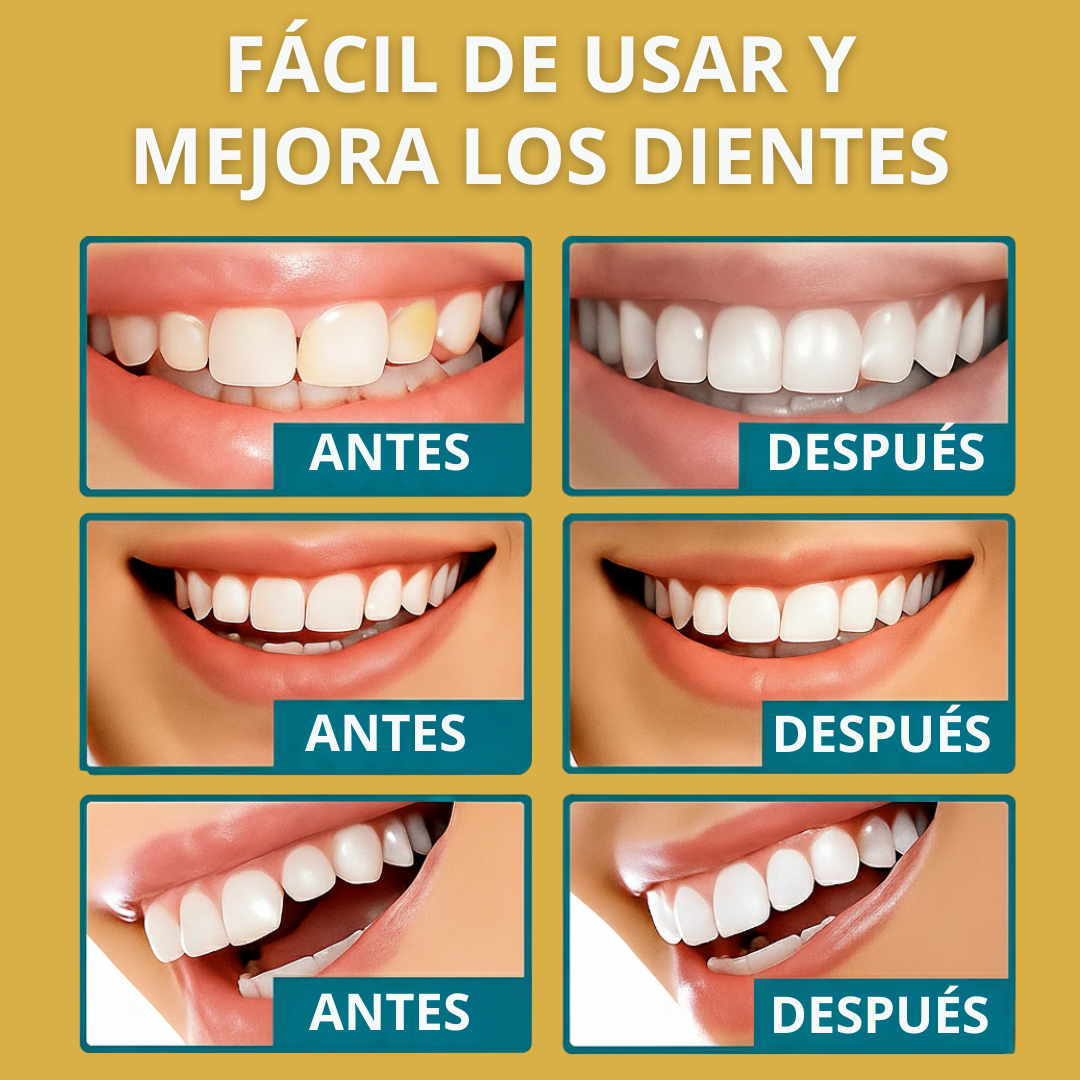 ¡OFERTA DE HOY!⌛CARILLAS DENTALES ADAPTABLES 2X1 +ENVIO GRATIS🏡🚚
