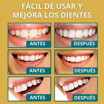¡OFERTA DE HOY!⌛CARILLAS DENTALES ADAPTABLES 2X1 +ENVIO GRATIS🏡🚚