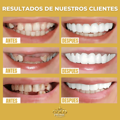 ¡OFERTA DE HOY!⌛CARILLAS DENTALES ADAPTABLES 2X1 +ENVIO GRATIS🏡🚚